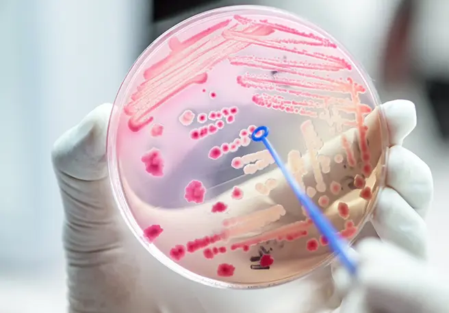 Der Darmflora-Aufbau nach Antibiotika ist häufig nötig