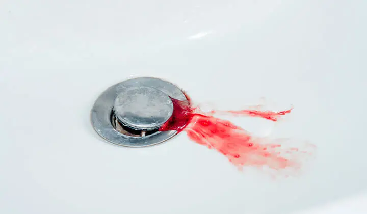 Bleeding gums can have various causes