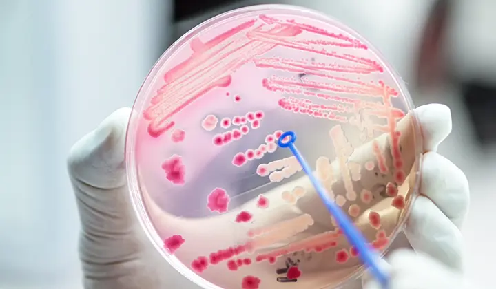 Der Darmflora-Aufbau nach Antibiotika ist häufig nötig